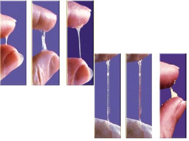 Consistența anterior -ejacularea